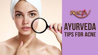Watch Best Ayurvedic Tips For Acne | Dr. Vibha Sharma (Ayurveda & Panchkarma Expert) Video