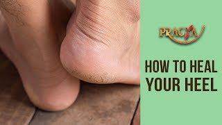 Watch How To Heal Your Heel- Dr. Vibha Sharma (Ayurveda & Panchkarma Expert) Video
