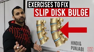 Watch Fix SLIP DISC BULGE Back Pain at Home! (Hindi / Punjabi) Video