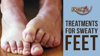 Watch Treatments For Sweaty Feet | Dr. Shehla Aggarwal (Dermatologist) Video