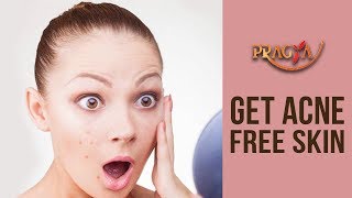 Watch Get Acne Free Skin | Payal Sinha (Naturopath Expert) Video