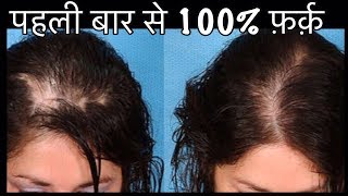 Watch DIY Hair Milk - How to Stop Hair Fall - Grow Long Thick Hair | 100% Natural Hair Loss Remedy Video