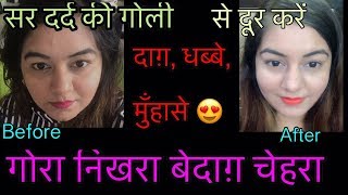 Watch à¤œà¤¼à¤¿à¤¦à¥à¤¦à¥€ à¤®à¥à¤¹à¤¾à¤à¤¸à¥‡ à¤¹à¤Ÿà¤¾à¤à¤ - à¤°à¤‚à¤— à¤¨à¤¿à¤–à¤¾à¤°à¥‡à¤‚ | Remove Pimples in 1 day | Get Fair GLOWING Spotless Clear skin Video