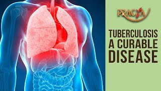 Watch TUBERCULOSIS A Curable Disease | Dr. Rajal Jhamb (Consultant Physician) Video