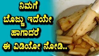 Watch à²¨à²¿à²®à²—à³† à²¬à³Šà²œà³à²œà³ à²‡à²¦à³†à²¯à³‡ à²¹à²¾à²—à²¾à²¦à²°à³† à²ˆ à²µà²¿à²¡à²¿à²¯à³‹ à²¨à³‹à²¡à²¿ | Kannada Health Facts | Top Kannada TV Video