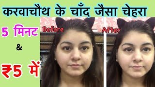 Watch à¤¦à¤¹à¥€ à¤¸à¥‡ à¤ªà¤¾à¤‡à¤ à¤—à¥‹à¤°à¤¾ à¤¨à¤¿à¤–à¤°à¤¾ à¤¬à¥‡à¤¦à¤¾à¤—à¤¼ à¤šà¥‡à¤¹à¤°à¤¾ | à¤•à¤°à¤µà¤¾à¤šà¥Œà¤¥ à¤ªà¤° | DIY Skin Whitening Remedy | JSuper Kaur Video