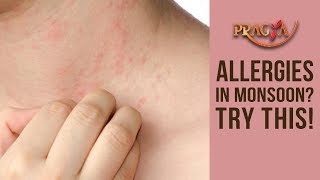 Watch Skin Allergy Tips | Dr. Shehla Agarwal (Dermatologist) | Pragya Health Guide Video
