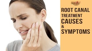 Watch Root Canal Treatment- Causes & Symptoms | Dr. Arunima Singhal Video
