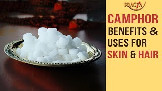 Watch CAMPHOR Benefits And Uses For SKIN & HAIR | Payal Sinha Video
