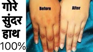 Watch Fair Hands in 5 min | How to get Milky Soft Hands at Home | Skin Whitening Natural Remedy Video