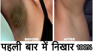 Watch How to Lighten Dark Underarms Naturally | DIY Skin Whitening Formula | JSuper Kaur Video