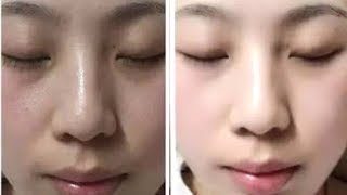 Watch How To Get Rid of Dull Skin in 5 minutes - Skin Whitening - Homemade Fairness Cream | JSuper Kaur Video