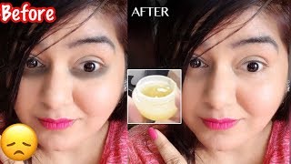 Watch DIY Eye Gel - How to Remove Dark Circles, Black Patches, Dark Spots | Natural Remedy | JSuper Kaur Video