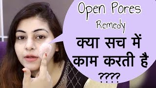Watch How to get rid of Large Pores Permanently - Young tighten skin | Open Pores Treatment | JSuper Kaur Video