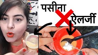 Watch Sunburn, Skin Allergy Treatment - Instant Relief | How to Remove Rashes | JSuper Kaur Video