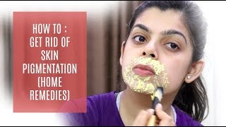 Watch HOW TO : GET RID OF SKIN PIGMENTATION | HOME REMEDIES Video