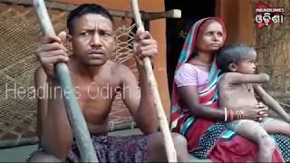 Watch Father & Daughter Of Patna Suffered With Critical Disease Video