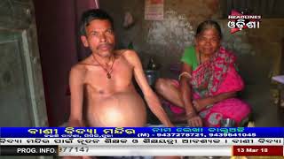 Watch Man Suffering With Critical Health Problem Video