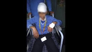 Watch Stone-pelters target school bus with 35 children in Kashmir, injure boy Video