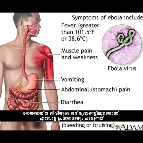 Watch Ebola Virus Disease Video