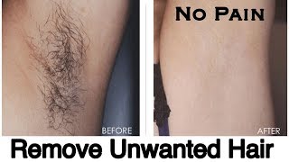 Watch Remove Unwanted Hair Without PAIN & Get Glowing Smooth Skin | Get Rid of Body Hair | JSuper Kaur Video