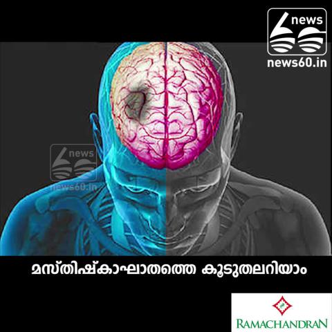 Watch Stroke- symptoms and causes Video