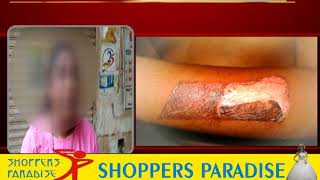 Watch Horror At Vasco Day Care! 9 year Old Burned With Tong Video