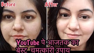 Watch à¤…à¤¨à¤šà¤¾à¤¹à¥‡ à¤¬à¤¾à¤²à¥‹à¤‚ à¤¸à¥‡ à¤›à¥à¤Ÿà¤•à¤¾à¤°à¤¾ & à¤—à¥‹à¤°à¥€ à¤¨à¤¿à¤–à¤°à¥€ à¤¤à¥à¤µà¤šà¤¾ | Whitening + Unwanted Hair Removal 2 in 1 Remedy Video
