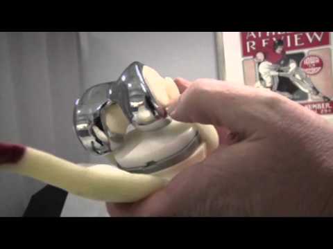 Watch Millions Living With Artificial Hips and Knees News Video Video