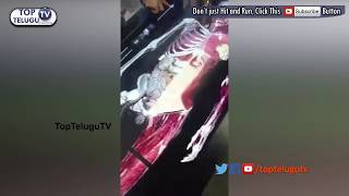Watch C.T Scan, MRI, X'RAYS  will go off. New digital technology has arrived | Top Telugu TV Video