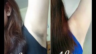 Watch How to get Smooth Fairer Underarms Instantly Video