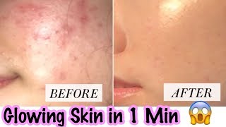 Watch Glowing Clear Skin in 1 min ! Remedy for Open Pores, Pimples, Dark Spots | JSuper Kaur Video
