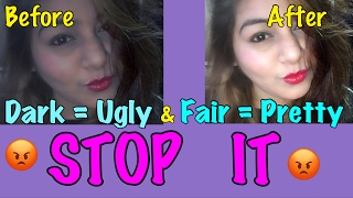 Watch Must Watch - UnFair & Lovely | JSuper Kaur Video