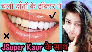 Watch à¤¦à¤¾à¤à¤¤à¥‹à¤‚ à¤•à¥€ à¤¸à¤­à¥€ à¤ªà¤°à¥‡à¤¶à¤¾à¤¨à¤¿à¤¯à¥‹à¤‚ à¤•à¤¾ à¤‡à¤²à¤¾à¤œ | Teeth Whitening - Healthy Tips Teeth | JSuper Kaur Video