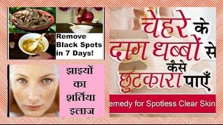 Watch REMOVE DARK SPOTS, PIGMENTATION, ACNE MARKS, UNEVEN SKIN TONE | Get FLAWLESS skin | 100% WORKS | Video