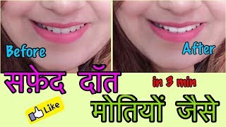 Watch How to Whiten Teeth at home | Proof in LIVE video - 100% Effective | JSuper Kaur Video