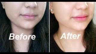Watch How to Lighten Skin Naturally in 20 Minutes Video