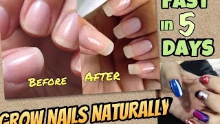 Watch DIY Nail Growth Recipe | How to grow Nails Fast NATURALLY in 5 days | Top TIPS - JSuper Kaur Video