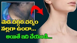 Watch à°®à±†à°¡ à°¦à°—à±à°—à°° à°¨à°²à±à°²à°—à°¾ à°‰à°‚à°¦à°¾ ? à°…à°¯à°¿à°¤à±‡ à°‡à°²à°¾ à°šà±‡à°¯à°‚à°¡à°¿ | Home Remedies to get rid Dark Ring on Neck | Health Tips Video