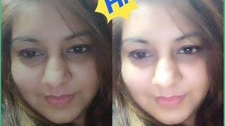 Watch How to shrink open pores at home in 1 day |  easy | men &  women | MIRACLE GLOW | JSuper Kaur Video
