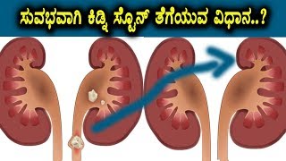 Watch Very easy steps to remove kidney stone or avoid | Health News | Kannada Health videos | Kannada TV Video