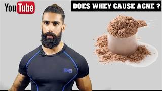 Watch Does WHEY PROTEIN give PIMPLES/ACNE (in Hindi) à¥¤ Whey Protein Side Effects Video