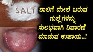 Watch à²¨à²¾à²²à²¿à²—à³† à²®à³‡à²²à²¿à²¨ à²—à³à²³à³à²³à³†à²—à²³à²¿à²—à³† à²¸à³à²²à³à²­ à²‰à²ªà²¾à²¯ | Kannada Health Videos | Health Tips Top Kannada TV | Video