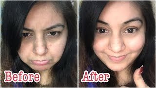 Watch à¤®à¤²à¤¾à¤ˆ à¤œà¥ˆà¤¸à¥€ à¤®à¥à¤²à¤¾à¤¯à¤® à¤¨à¤¿à¤–à¤°à¥€ à¤¤à¥à¤µà¤šà¤¾ | Facial at home - Coconut Milky White Fair skin - Demo in Live Video Video