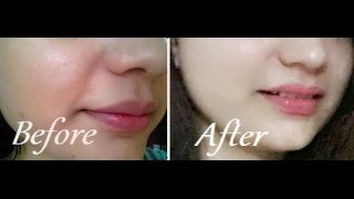 Watch How to Remove Sun Tan From Your Face & Neck Instantly Video