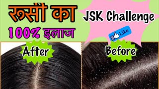 Watch How to remove dandruff naturally in 1 Wash | Home remedy to Cure Dandruff & Hairfall | Jsuper Kaur Video