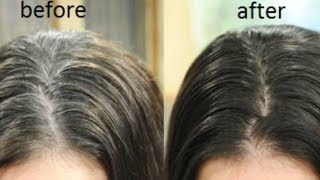 Watch Natural Hair Dye for Instant Black Hair | Turn white to black hair in 1 minute | JSuper Kaur Video