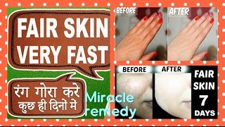 Watch Skin WHITENING MAGICAL remedy (RESULTS in LIVE VIDEO) | Get FAIR skin at HOME in 1 week | 100% WORKS Video