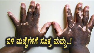 Watch Best Treatment for White spots on the skin | Kannada Health Videos | Top Kannada TV Video