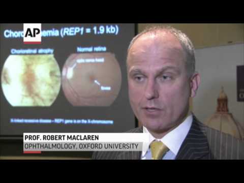 Watch Gene Therapy May Treat Rare Form of Blindness News Video Video
